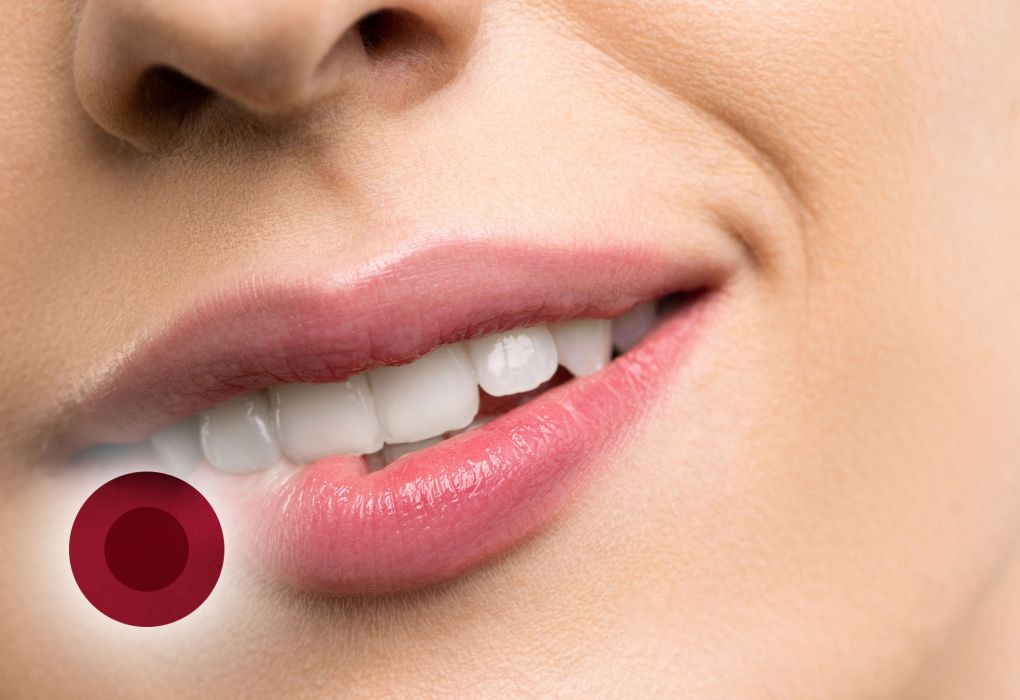 Die Mundpartie einer Frau, die sich auf die Lippe beißt, als ein Zeichen für eine Herpesinfektion.