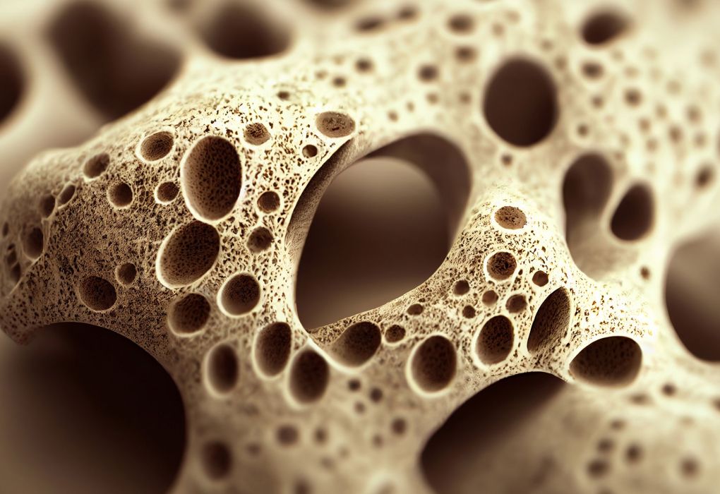 Detailansicht poröser Knochenstruktur bei Osteoporose