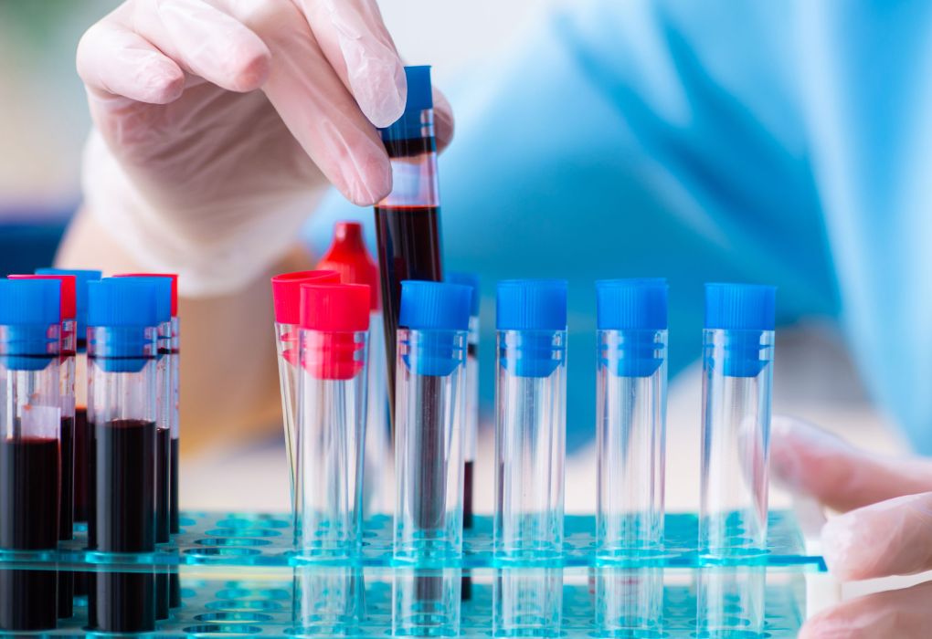 Hand hält Reagenzgläser mit Blutproben im Labor.