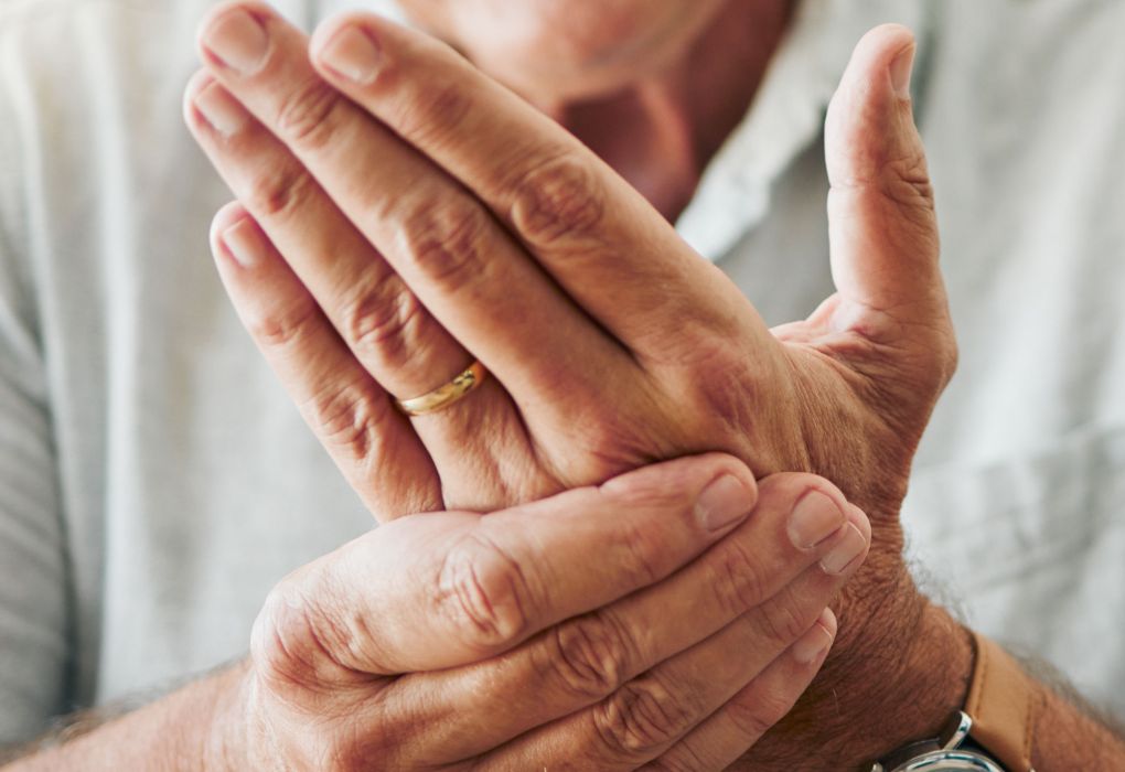 Gefaltete Hände einer älteren Person mit sichtbaren Anzeichen von Osteoporose oder Gelenkbeschwerden