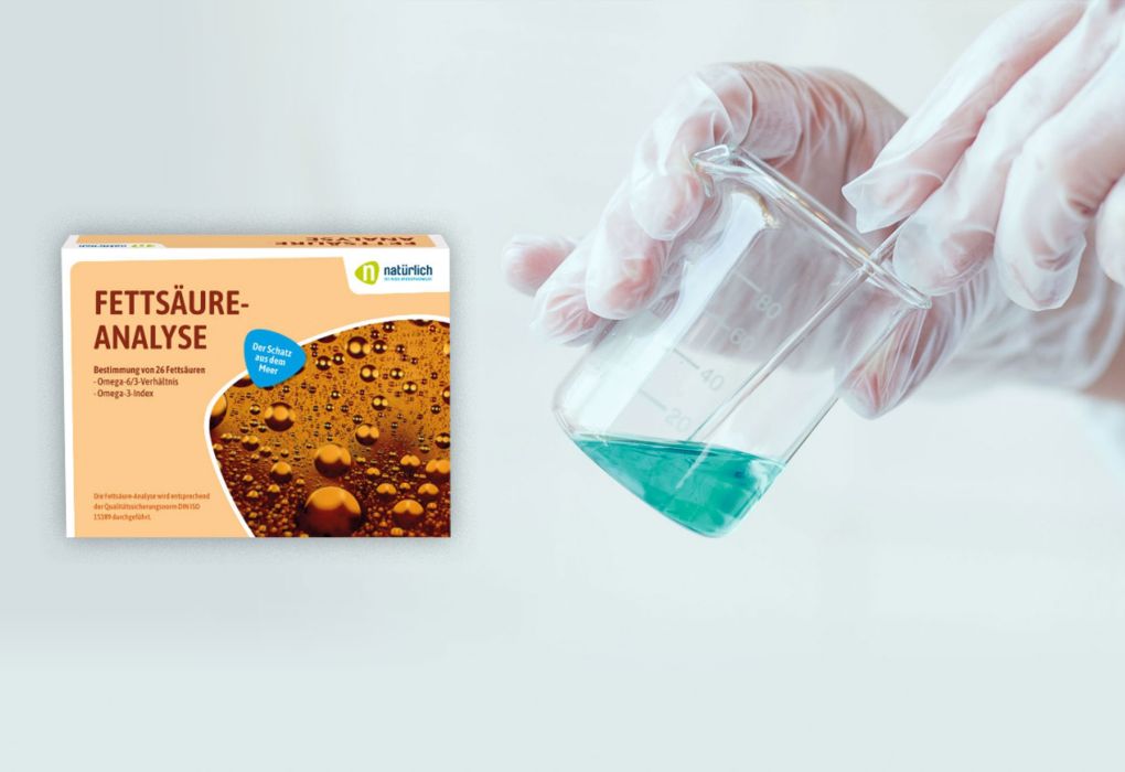 Fettsäure-Analyse