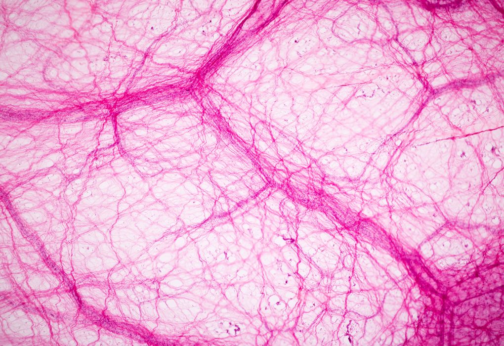 Rosa gefärbte Mikroskopaufnahme von elastischem menschlichem Bindegewebe