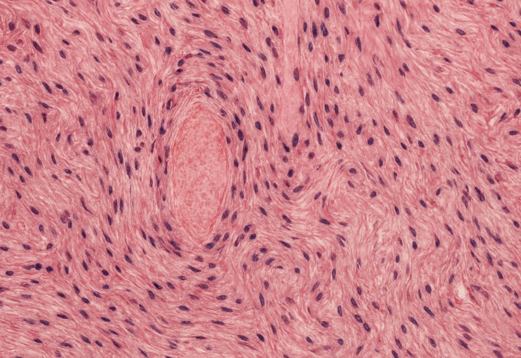 Rosa gefärbte Gewebestruktur in mikroskopischer Aufnahme.