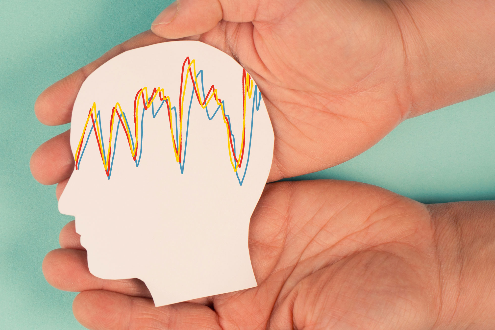Hand hält ein Kopfmodell mit gezackten Linien als Symbol für epileptische Anfälle