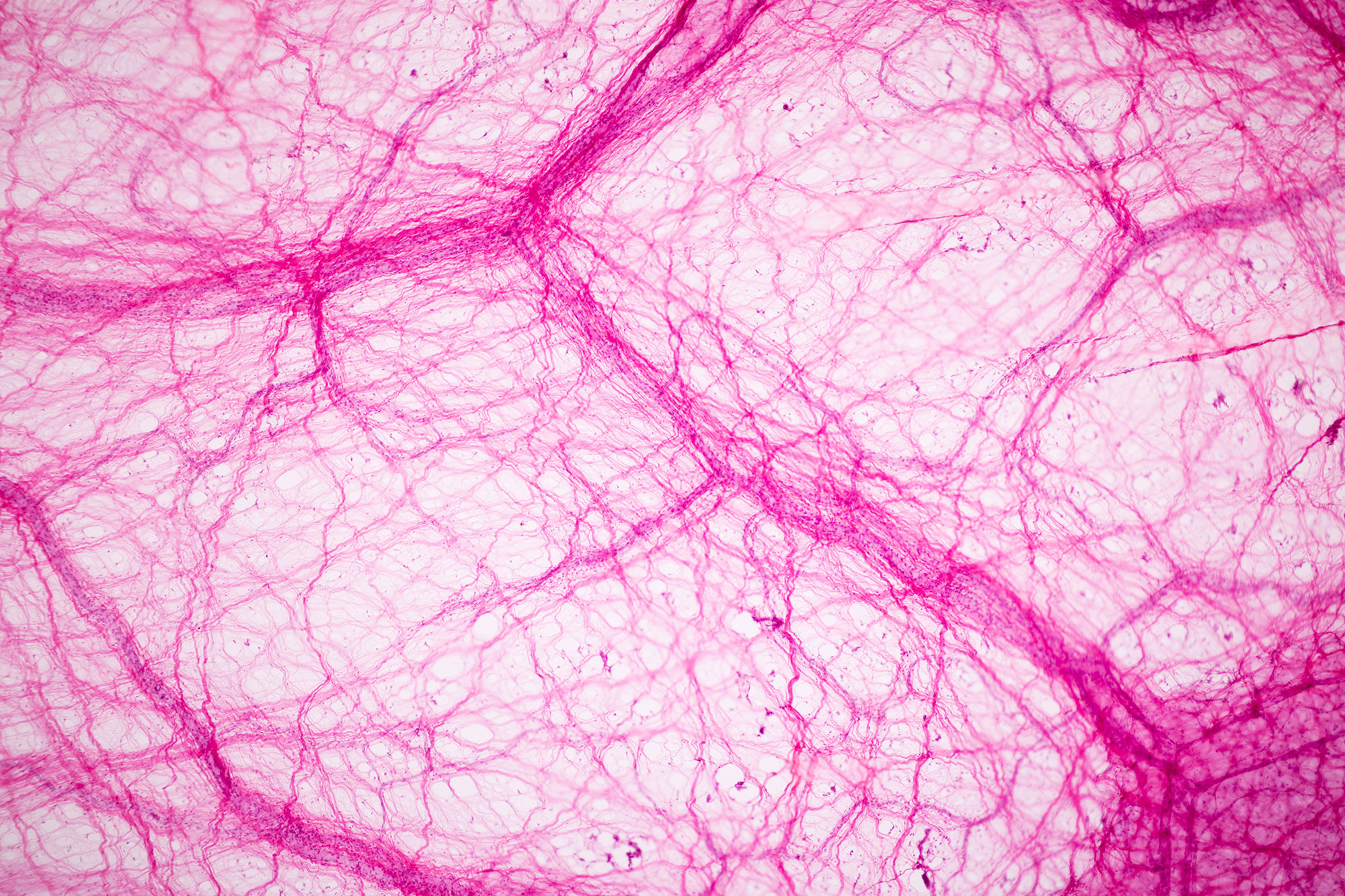Rosa gefärbte Mikroskopaufnahme von elastischem menschlichem Bindegewebe
