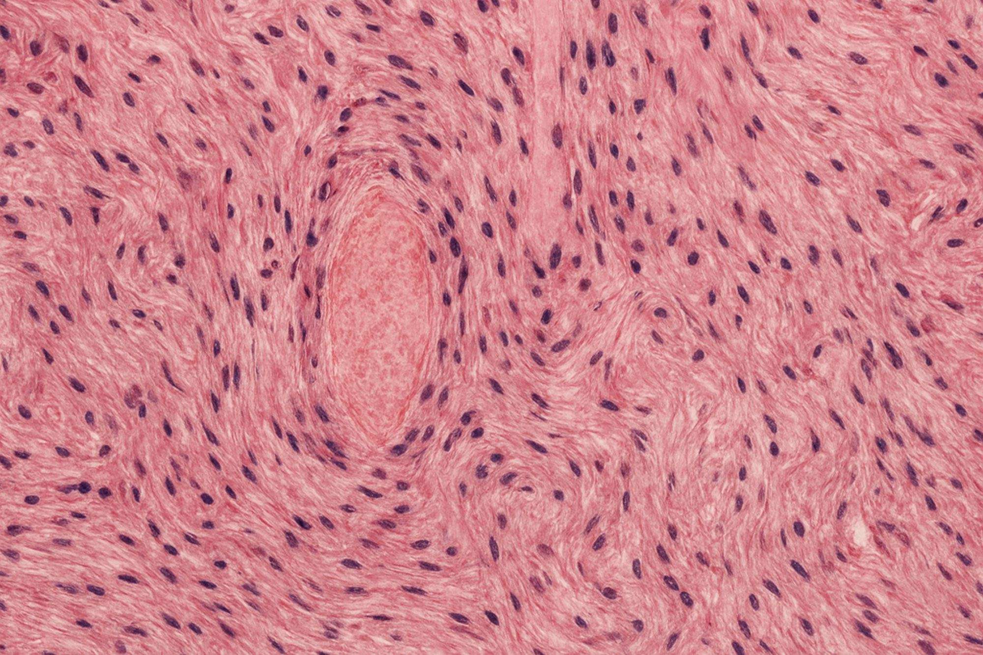 Rosa gefärbte Gewebestruktur in mikroskopischer Aufnahme.